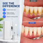 Portable Ultrasonic Teeth Cleaner and Tartar Remover Set
